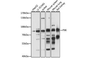 Western blot analysis of extracts of various cell lines, using PXK antibody (ABIN6290773) at 1:1000 dilution. (PXK 抗体)