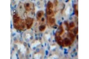 #VALUE! (beta Actin 抗体  (AA 1-375))