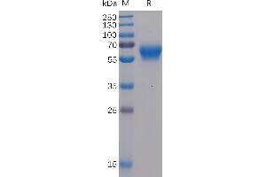 SDS-PAGE (SDS) image for B and T Lymphocyte Associated (BTLA) (AA 31-150) protein (mFc-His Tag) (ABIN6961116)