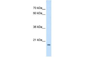 ASF1B antibody used at 1 ug/ml to detect target protein. (ASF1B 抗体)