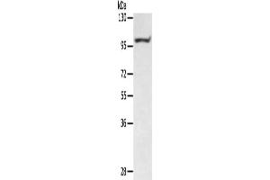 Gel: 6 % SDS-PAGE, Lysate: 40 μg, Lane: Mouse muscle tissue, Primary antibody: ABIN7130772(PTPN22 Antibody) at dilution 1/400, Secondary antibody: Goat anti rabbit IgG at 1/8000 dilution, Exposure time: 5 minutes (PTPN22 抗体)