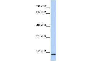 WB Suggested Anti-TMEM35 Antibody Titration:  0. (TMEM35 抗体  (C-Term))