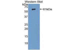 Western Blotting (WB) image for anti-beta-Adrenergic Receptor Kinase (AA 398-640) antibody (ABIN1857927) (beta-Adrenergic Receptor Kinase (AA 398-640) 抗体)