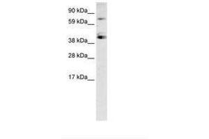 Image no. 2 for anti-Sp7 Transcription Factor (SP7) (C-Term) antibody (ABIN6735947) (SP7 抗体  (C-Term))