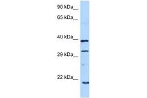 Image no. 1 for anti-Growth Hormone 1 (GH1) (C-Term) antibody (ABIN6748200) (Growth Hormone 1 抗体  (C-Term))