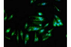Immunofluorescent analysis of Hela cells using ABIN7170696 at dilution of 1:100 and Alexa Fluor 488-congugated AffiniPure Goat Anti-Rabbit IgG(H+L) (SND1 抗体  (AA 560-732))
