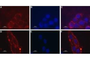Expression of Melanin-concentrating hormone receptor 1 in mouse brain glioma - Cell surface detection of MCHR1 in mouse brain glioma (C6) intact living cells. (MCHR1 抗体  (Extracellular))