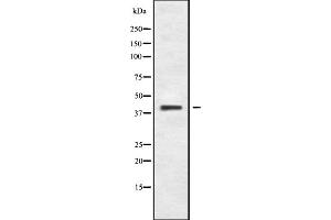 Western blot analysis of CCR8 using COLO205 whole cell lysates (CCR8 抗体  (C-Term))