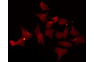 ABIN6269394 staining Hela by IF/ICC.