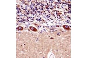 Immunohistochemistry analysis in formalin fixed and paraffin embedded human cerebellum tissuereacted with KCNA1 Antibody (Center) followed which was peroxidase conjugated to the secondary antibody and followed by DAB staining. (KCNA1 抗体  (Middle Region))