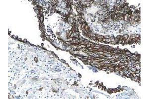 Immunohistochemistry (IHC) image for anti-Podoplanin (PDPN) antibody (ABIN180856)