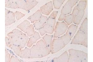 Immunohistochemistry (IHC) image for anti-Myosin, Light Chain 6B, Alkali, Smooth Muscle and Non-Muscle (MYL6B) (AA 6-137) antibody (ABIN7439591)