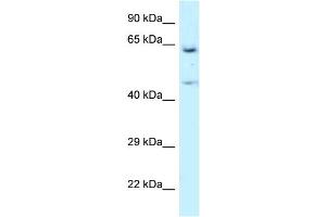 WB Suggested Anti-NARS Antibody Titration: 1. (NARS 抗体  (N-Term))