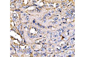 IHC analysis of NEAS/SPTAN1 using anti-NEAS/SPTAN1 antibody (ABIN7600436).