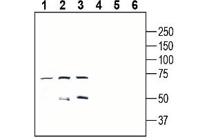 Western blot analysis of mouse EL4 T-cell lymphoma cell line lysate (lanes 1 and 4), mouse  B-cell lymphoma cell line lysate (lanes 2 and 5) and mouse  microglia cell line lysate (lanes 3 and 6):1-3. (GPR18 抗体  (Extracellular))
