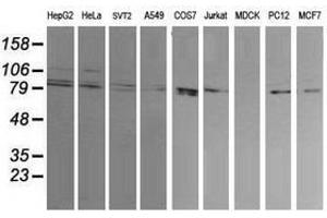 Image no. 2 for anti-Dynamin 1-Like (DNM1L) antibody (ABIN1497871) (Dynamin 1-Like 抗体)