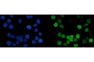IF analysis of MCM6 using anti-MCM6 antibody (ABIN7600038). (MCM6 抗体  (AA 14-821))