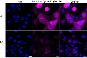 Immunocytochemical staining of HT- cells using Phospho-Cyclin B1 (Ser126) antibody (ABIN7798192), 1:1,000), Top panel: wild-type (WT), Bottom panal: Phospho-Cyclin B1 (Ser126) shRNA knockdown (KD).