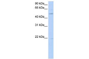 WB Suggested Anti-RORB Antibody Titration:  0. (RORB 抗体  (C-Term))