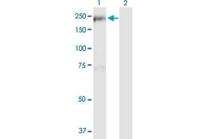 Western Blotting (WB) image for anti-TBC1 (Tre-2/USP6, BUB2, Cdc16) Domain Family, Member 1 (TBC1D1) (AA 1-1168) antibody (ABIN525033)