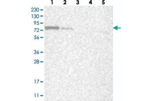 Western blot analysis of Lane 1: RT-4, Lane 2: U-251 MG, Lane 3: Human Plasma, Lane 4: Liver, Lane 5: Tonsil with LARP7 polyclonal antibody  at 1:250-1:500 dilution.