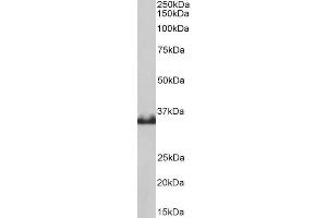 Western Blotting (WB) image for anti-Lactate Dehydrogenase B (LDHB) antibody (ABIN5870352) (LDHB 抗体)