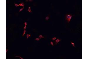 ABIN6266681 staining SNKSH cells by IF/ICC. (NK6 Homeobox 3 抗体  (Internal Region))