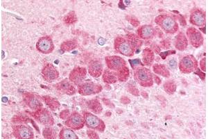 Anti-MINK1 / MAP4K6 antibody  ABIN1049061 IHC staining of rat hippocampus. (MAP4K6 抗体  (Internal Region))