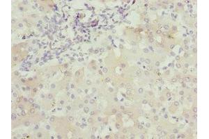 Immunohistochemistry of paraffin-embedded human liver tissue using ABIN7175453 at dilution of 1:100 (BNIP1 抗体  (AA 1-200))