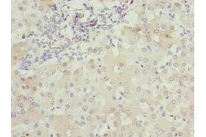Immunohistochemistry of paraffin-embedded human liver tissue using ABIN7175453 at dilution of 1:100