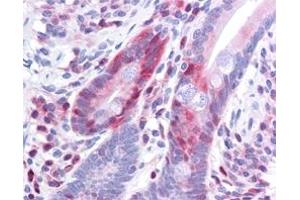 Immunohistochemistry (IHC) image for anti-Programmed Cell Death 4 (PDCD4) (pSer457) antibody (ABIN400797) (PDCD4 抗体  (pSer457))