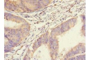 Immunohistochemistry (IHC) image for anti-Salvador Homolog 1 (SAV1) (AA 1-210) antibody (ABIN7166096)