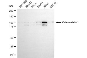 Western blotting analysis using catenin delta 1 antibody (ABIN7797933).