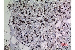 Immunohistochemistry (IHC) analysis of paraffin-embedded Human Breast, antibody was diluted at 1:100. (NF-kB p65 抗体  (acLys218))