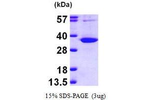 Uridine Phosphorylase 1 (UPP1) (AA 1-310) protein (His tag)