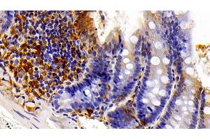 Detection of GAL3 in Rat Colon Tissue using Polyclonal Antibody to Galectin 3 (GAL3) (Galectin 3 抗体  (AA 1-262))