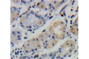 Used in DAB staining on fromalin fixed paraffin-embedded Stomach tissue (UBD 抗体  (AA 1-165))