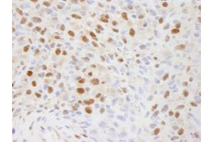 Immunohistochemistry (IHC) image for anti-Elongation Factor Tu GTP Binding Domain Containing 2 (EFTUD2) (AA 1-50) antibody (ABIN7448542)
