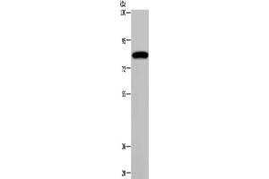 Gel: 6 % SDS-PAGE, Lysate: 40 μg, Lane: K562 cells, Primary antibody: ABIN7191804(PCDHAC1 Antibody) at dilution 1/200, Secondary antibody: Goat anti rabbit IgG at 1/8000 dilution, Exposure time: 1 minute (PCDHAC1 抗体)
