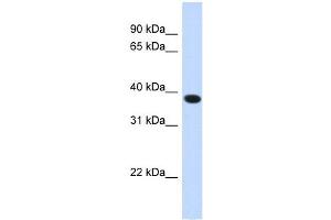 ACBD4 antibody used at 1 ug/ml to detect target protein. (ACBD4 抗体  (N-Term))
