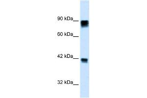 WB Suggested Anti-RB1 Antibody Titration: 0. (Retinoblastoma 1 抗体  (C-Term))