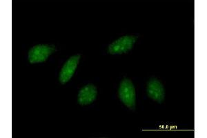 Immunofluorescence of purified MaxPab antibody to HLX on HeLa cell. (HLX 抗体  (AA 1-488))