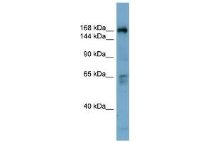 WB Suggested Anti-DOCK2 Antibody Titration: 0.
