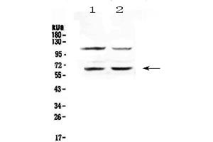 Western blot analysis of AMPK alpha 1 using anti-AMPK alpha 1 antibody . (PRKAA1 抗体  (AA 377-446))