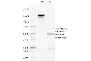 SDS-PAGE Analysis Purified CD22 Mouse Monoclonal Antibody (LPFS2/1611). (CD27 抗体)