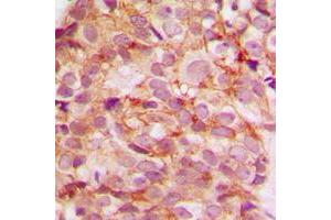 Immunohistochemistry (IHC) image for anti-Collagen, Type V, alpha 3 (COL5A3) (N-Term) antibody (ABIN7298124)