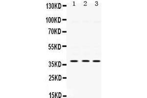 Western Blotting (WB) image for anti-Protein Kinase, AMP-Activated, beta 1 Non-Catalytic Subunit (PRKAB1) (AA 32-68), (N-Term) antibody (ABIN3043359)