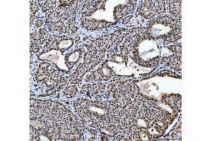 IHC analysis of HNRNPL using anti-HNRNPL antibody (ABIN4886624).