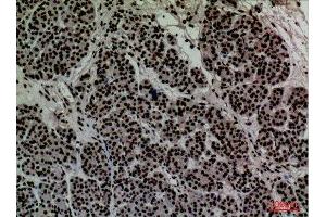 Immunohistochemistry (IHC) analysis of paraffin-embedded Human Pancreas, antibody was diluted at 1:100. (CD2 抗体  (N-Term))