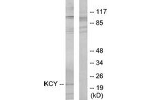 Western blot analysis of extracts from HeLa cells, using KCY Antibody. (KCY (AA 1-50) 抗体)